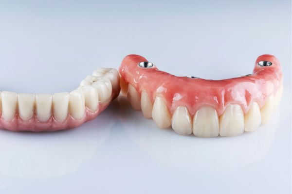 Set of dental implant teeth