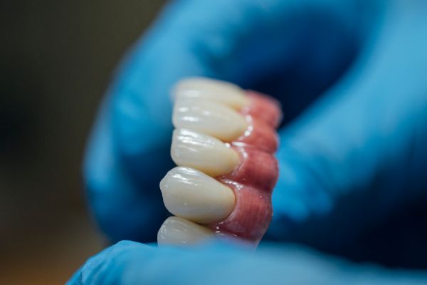 Implant teeth