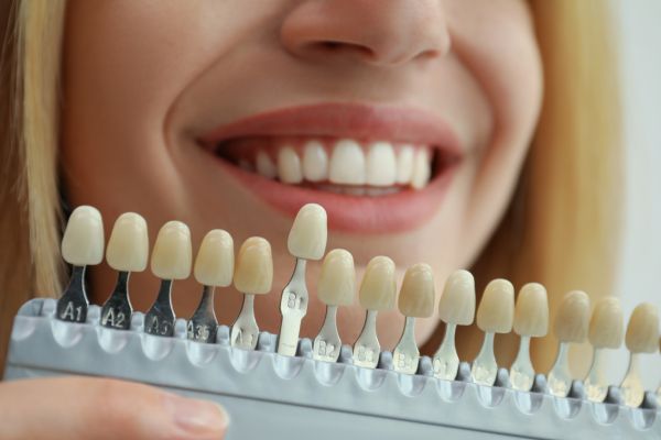 Cosmetic Dentistry In Newport - Close-up photo of a tooth colour chart being held up to a woman's teeth, checking the colour match.