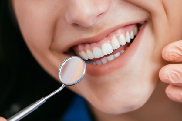 About Us Page - Close-up photo of a smiling woman holding a dental mirror up to her teeth.